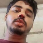 जयपुर के कोटा राष्ट्रीय राजमार्ग पर कार खम्भे से टकराई, कार में बैठे कॉलेज के छात्र की मौत,तीन घायल